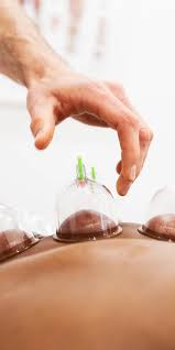Cupping